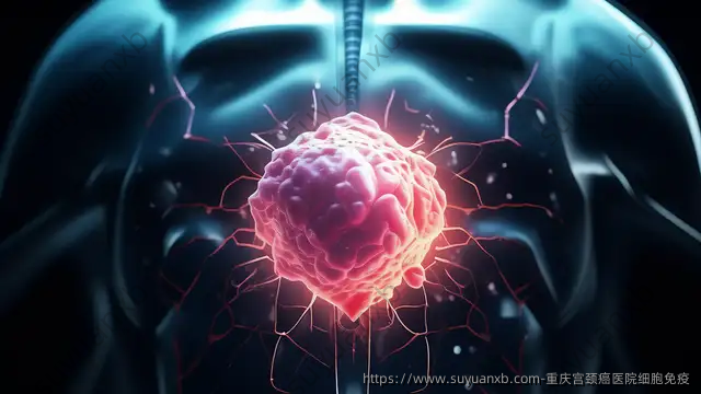 重庆宫颈癌医院细胞免疫